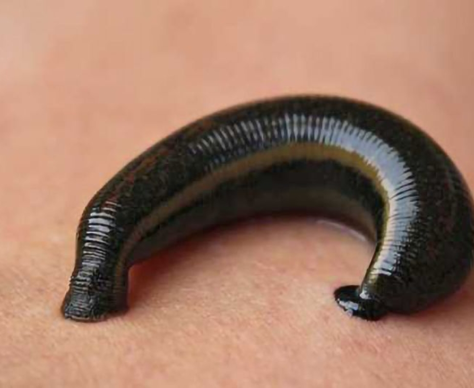 blood-clotting-ability-of-leeches-revealed-306085-960x540-2-2